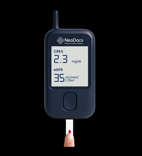 NeoDocs Creatinine Kidney Test Device
