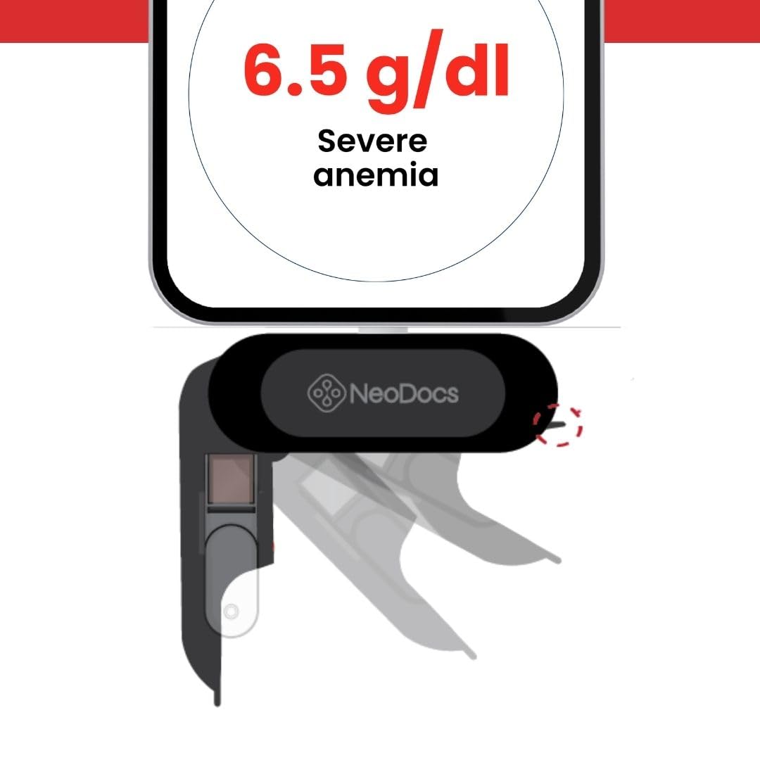 Neodocs Hemoglobin Test Kit Smartphone Based - Image 4